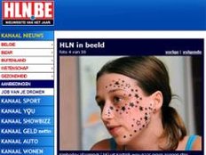 Das Gesicht&nbsp; von Kimberley Vlaeminck (18) wurde mit mit&nbsp;56 Sternen &bdquo;verziert&ldquo;.