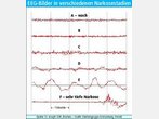 Mit modernen Verfahren lassen sich Medikamenten-Fehldosierungen vermeiden