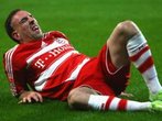 FC Bayern schon wieder ohne Franck Ribéry