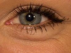 Augen: Ernährung kann Sehvermögen verbessern, sogar Makula-Degeneration