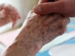 Rheumatoide Arthritis früh und gezielt behandeln