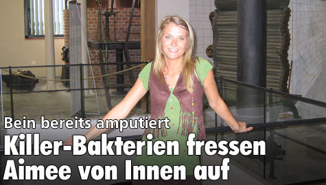 Killer-Bakterien fressen Frau von Innen auf