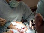 Schönheits-OPs an Minderjährigen bleiben vorerst erlaubt