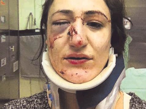 Schwer verletzt: die 23-j&auml;hrige Frau. fkn