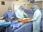 Fettabsaugung bei Männern: Die wichtigsten Fragen und Antworten