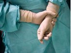 Mandel-Operation: Vollständige Entfernung der Mandeln ist oft nicht sinnvoll