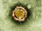 Das neue Coronavirus ist nun auch in Frankreich aufgetaucht
