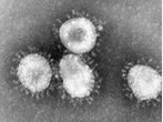 Zweiter Coronavirus-Fall in Frankreich bestätigt