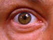 Augen