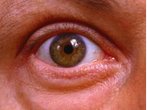 Karotte oder Sonnenbrille - Umfrage, wie Deutsche ihre Augen fit halten