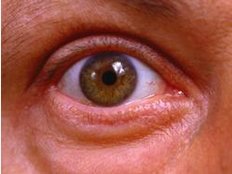 Karotte oder Sonnenbrille - Umfrage, wie Deutsche ihre Augen fit halten