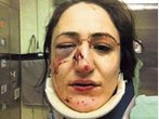 Teresa Z., Prügelopfer aus der Au: Staatsanwaltschaft erhebt Anklage gegen Polizisten
