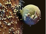 Fotos zeigen Luft unterm Mikroskop: Pollen, Tonerstaub werden sichtbar 