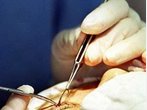 Große Brüste, Lidstraffungen und Fettabsaugungen -Schönheitsoperationen in Deutschland 